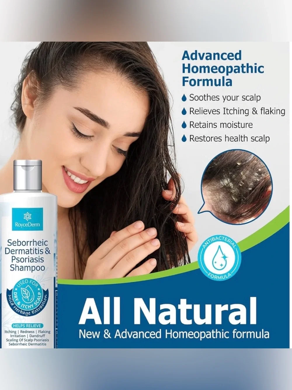 RoyceDerm Seborrheic Dermatitis & Psoriasis Shampoo 250mL EXP 2027 New / Sealed